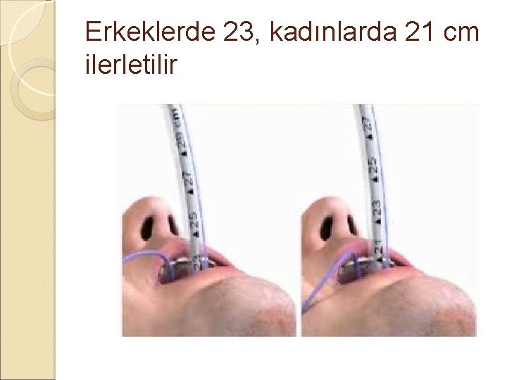 Erkeklerde 23, kadınlarda 21 cm ilerletilir Erkeklerde 23, kadınlarda 21 cm ilerletilir