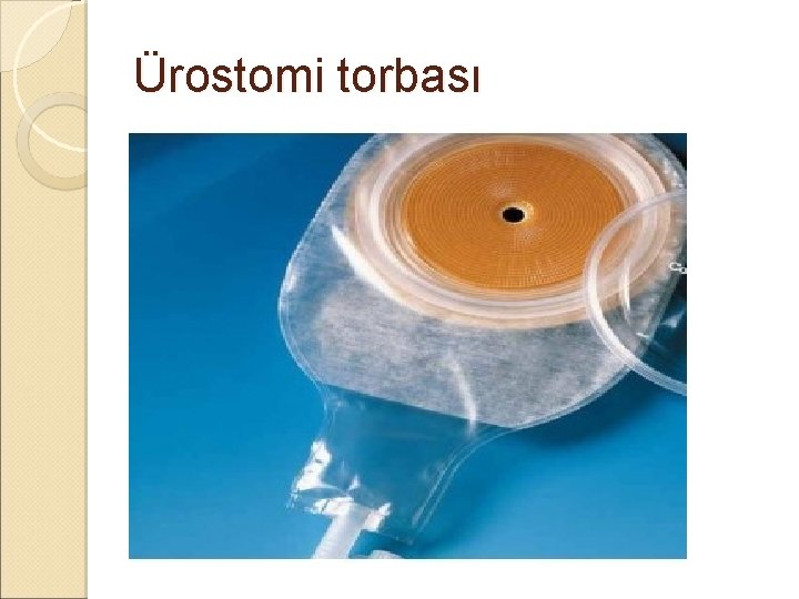 Ürostomi torbası Ürostomi torbası