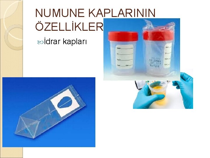 NUMUNE KAPLARININ ÖZELLİKLERİ İdrar kapları NUMUNE KAPLARININ ÖZELLİKLERİ İdrar kapları