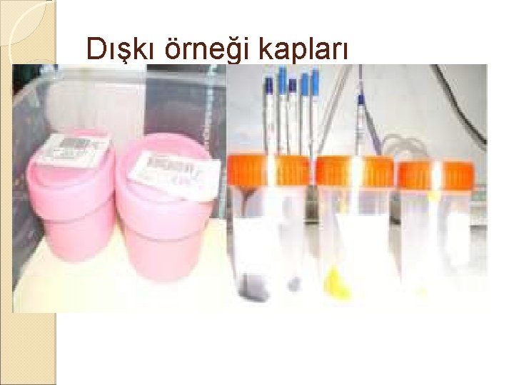 Dışkı örneği kapları Dışkı örneği kapları