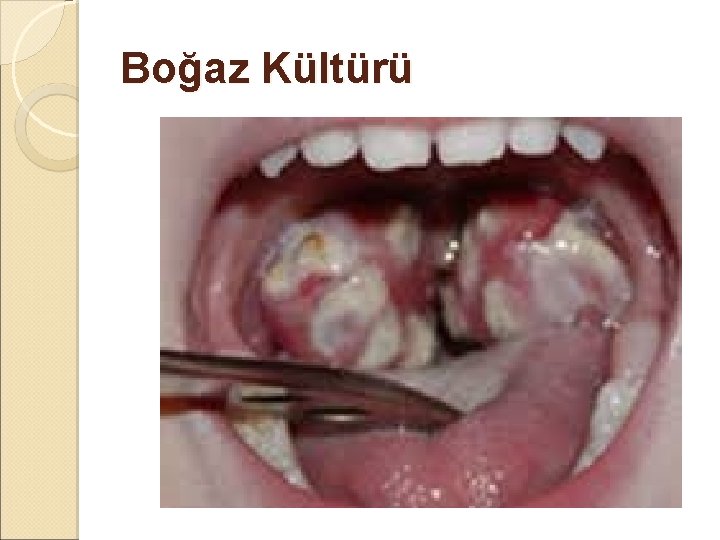 Boğaz Kültürü Boğaz Kültürü
