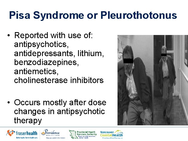Pisa Syndrome or Pleurothotonus • Reported with use of: antipsychotics, antidepressants, lithium, benzodiazepines, antiemetics, Pisa Syndrome or Pleurothotonus • Reported with use of: antipsychotics, antidepressants, lithium, benzodiazepines, antiemetics,
