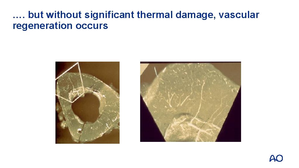 …. but without significant thermal damage, vascular regeneration occurs 