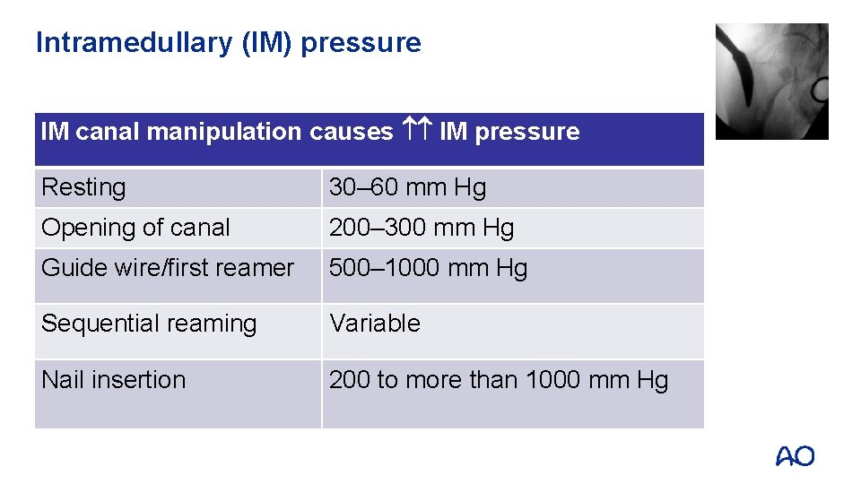 Intramedullary (IM) pressure IM canal manipulation causes IM pressure Resting 30– 60 mm Hg