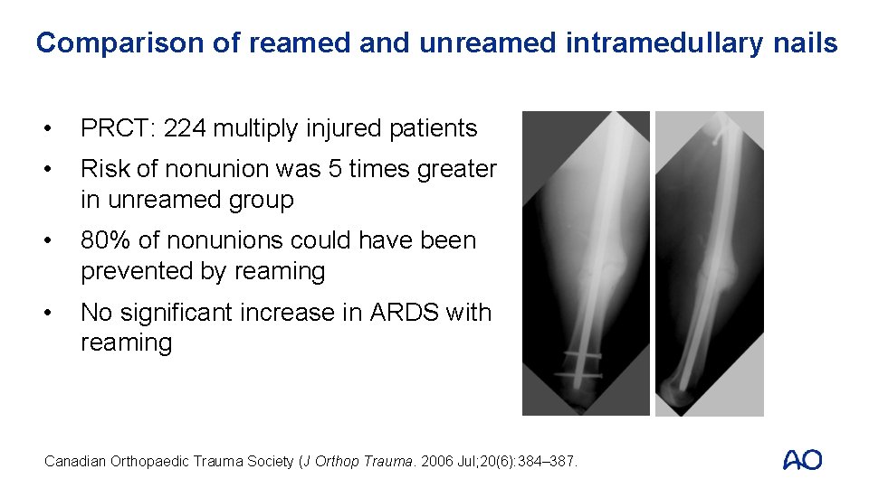 Comparison of reamed and unreamed intramedullary nails • PRCT: 224 multiply injured patients •