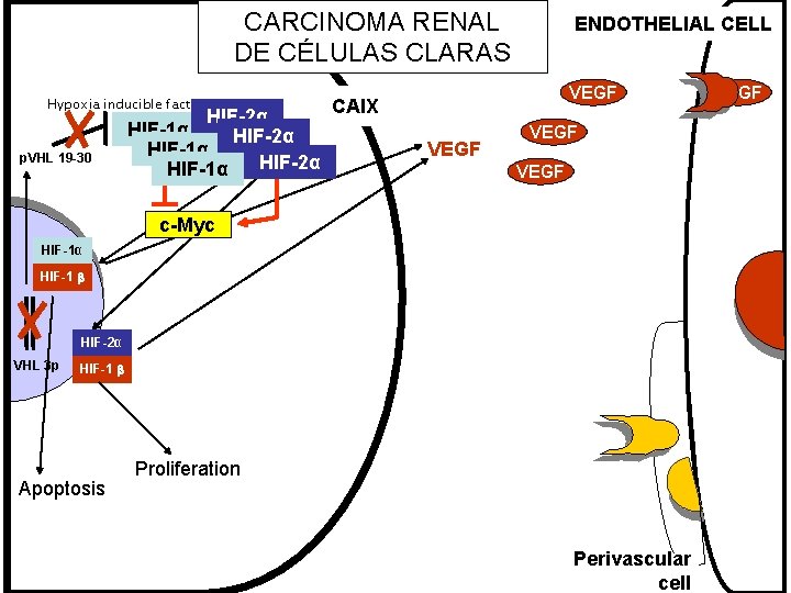 CARCINOMA RENAL DE CÉLULAS CLARAS Hypoxia inducible factor p. VHL 19 -30 HIF-2α HIF-1α CARCINOMA RENAL DE CÉLULAS CLARAS Hypoxia inducible factor p. VHL 19 -30 HIF-2α HIF-1α