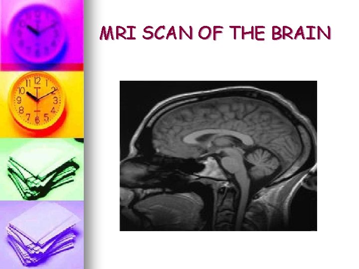 MRI SCAN OF THE BRAIN MRI SCAN OF THE BRAIN