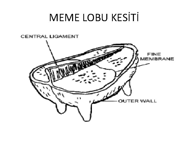 MEME LOBU KESİTİ 