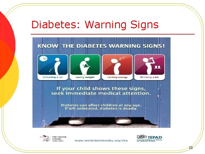 Diabetes: Warning Signs 18 