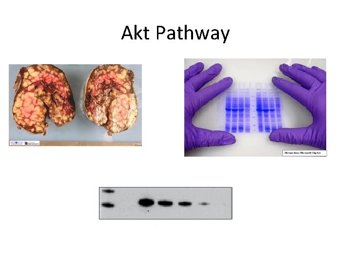 Akt Pathway 