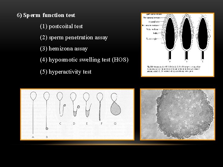  6) Sperm function test (1) postcoital test (2) sperm penetration assay (3) hemizona