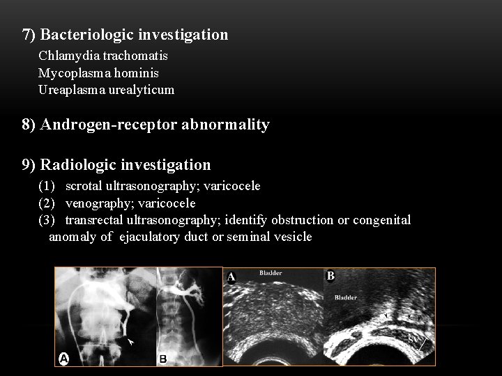 7) Bacteriologic investigation Chlamydia trachomatis Mycoplasma hominis Ureaplasma urealyticum 8) Androgen-receptor abnormality 9) Radiologic