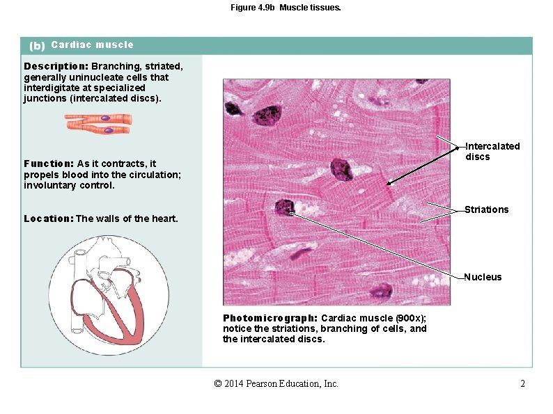 Figure 4. 9 b Muscle tissues. Cardiac muscle Description: Branching, striated, generally uninucleate cells