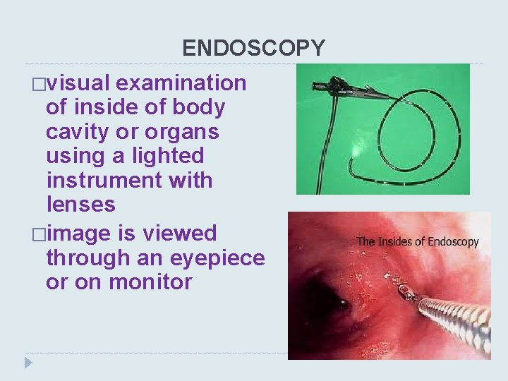 ENDOSCOPY �visual examination of inside of body cavity or organs using a lighted instrument