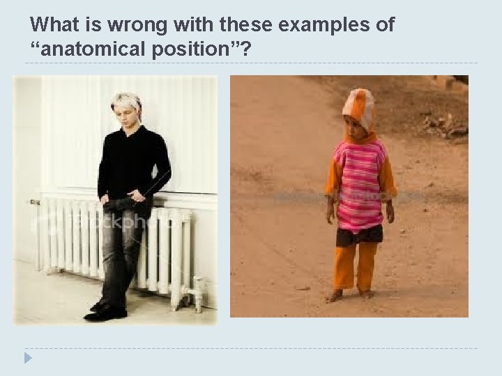 What is wrong with these examples of “anatomical position”? 