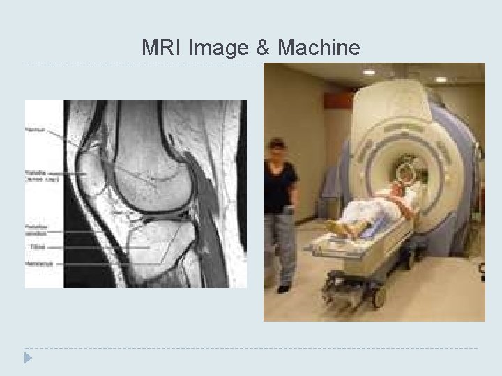 MRI Image & Machine 