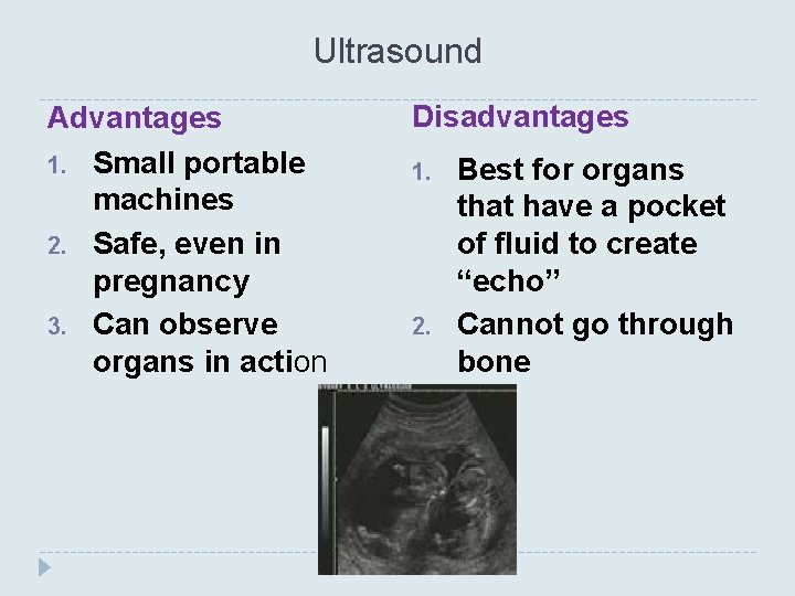 Ultrasound Advantages 1. Small portable machines 2. Safe, even in pregnancy 3. Can observe