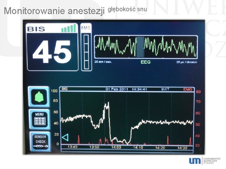 Monitorowanie anestezji głębokość snu 