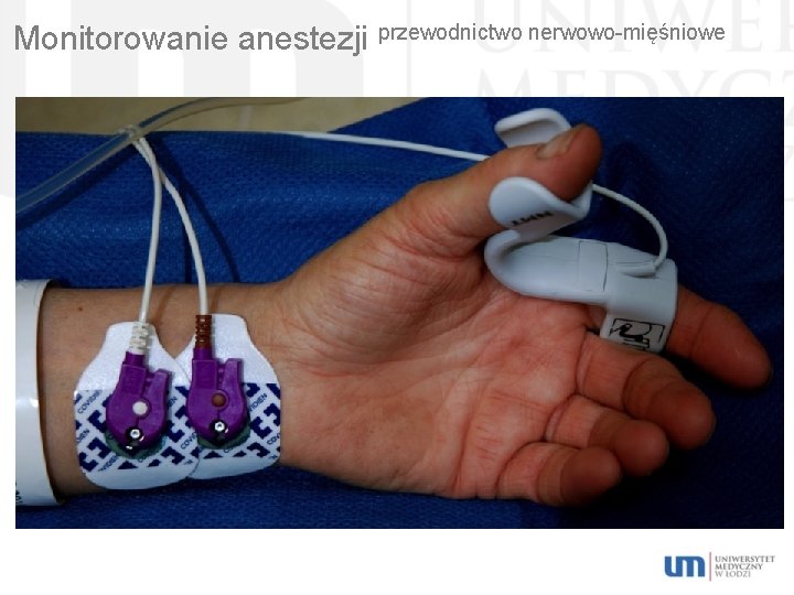 Monitorowanie anestezji przewodnictwo nerwowo-mięśniowe 