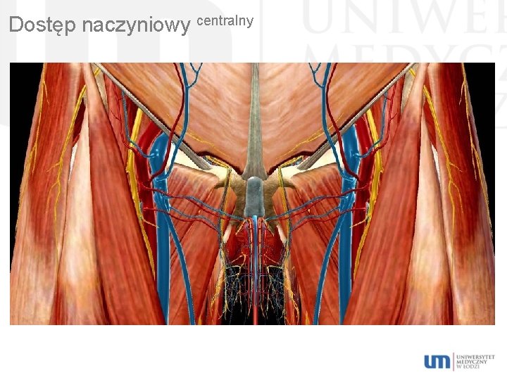 Dostęp naczyniowy centralny 