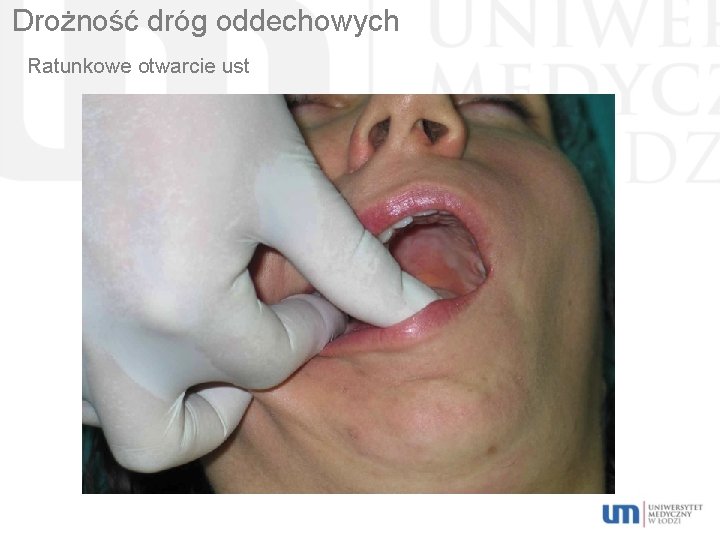 Drożność dróg oddechowych Ratunkowe otwarcie ust 