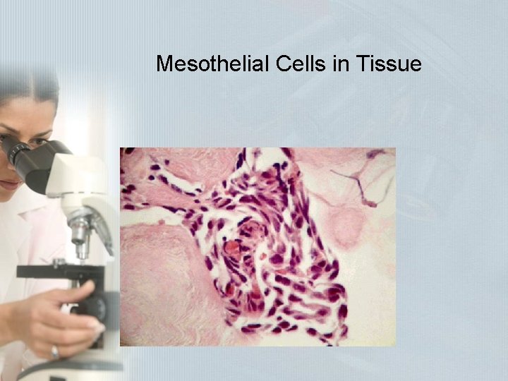 Mesothelial Cells in Tissue Mesothelial Cells in Tissue