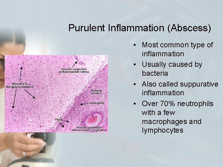 Purulent Inflammation (Abscess) • Most common type of inflammation • Usually caused by bacteria Purulent Inflammation (Abscess) • Most common type of inflammation • Usually caused by bacteria