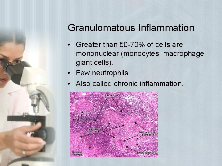 Granulomatous Inflammation • Greater than 50 -70% of cells are mononuclear (monocytes, macrophage, giant Granulomatous Inflammation • Greater than 50 -70% of cells are mononuclear (monocytes, macrophage, giant