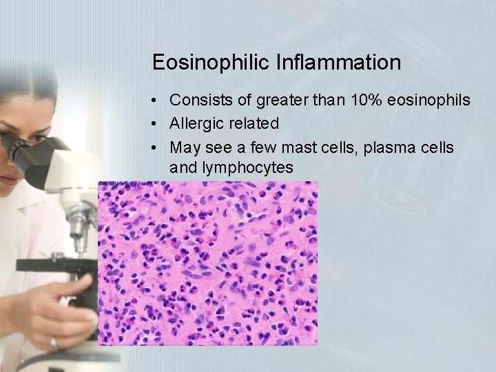 Eosinophilic Inflammation • Consists of greater than 10% eosinophils • Allergic related • May Eosinophilic Inflammation • Consists of greater than 10% eosinophils • Allergic related • May