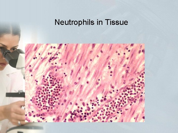 Neutrophils in Tissue Neutrophils in Tissue