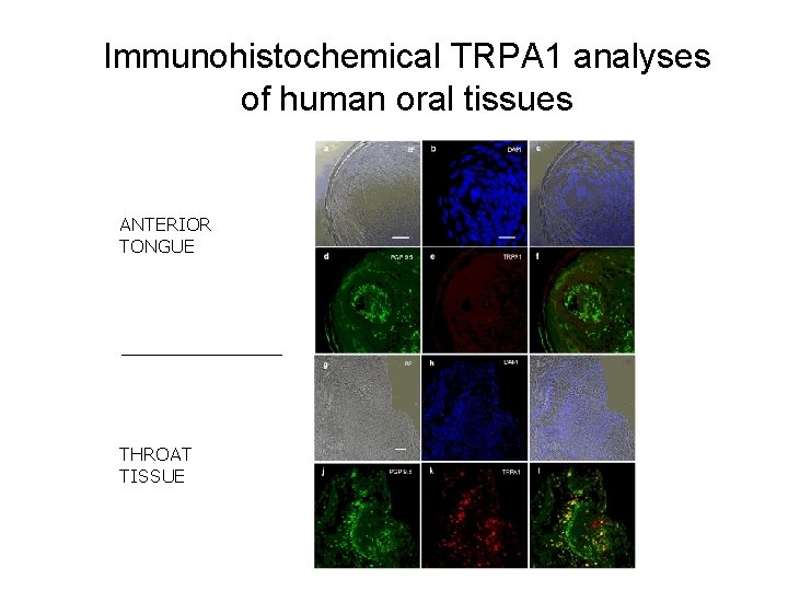 Immunohistochemical TRPA 1 analyses of human oral tissues ANTERIOR TONGUE THROAT TISSUE 