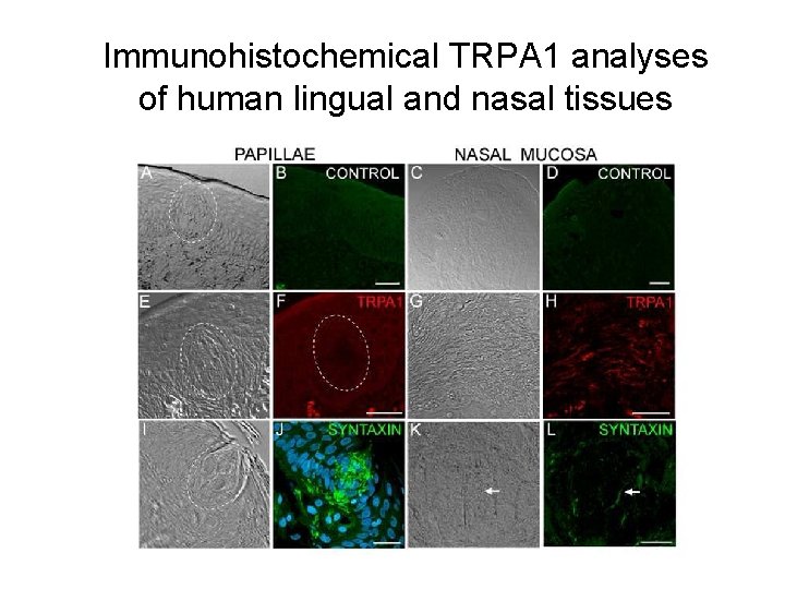 Immunohistochemical TRPA 1 analyses of human lingual and nasal tissues 