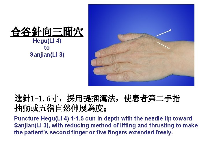 合谷針向三間穴 Hegu(LI 4) to Sanjian(LI 3) 進針 1 -1. 5寸，採用提插瀉法，使患者第二手指 抽動或五指自然伸展為度； Puncture Hegu(LI 4)