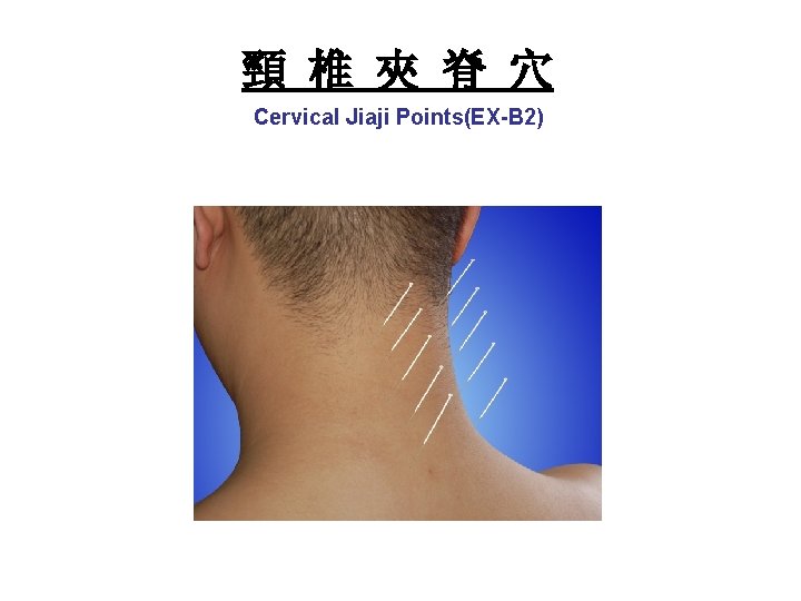 頸 椎 夾 脊 穴 Cervical Jiaji Points(EX-B 2) 