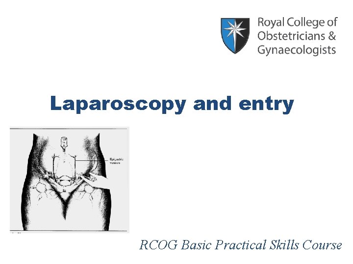 Laparoscopy and entry RCOG Basic Practical Skills Course 