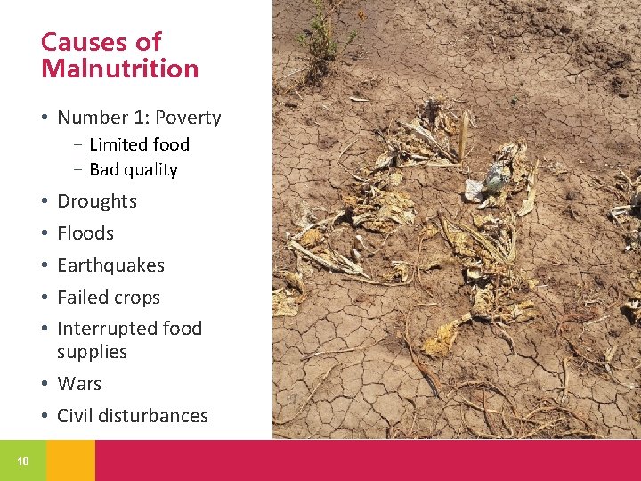 Causes of Malnutrition • Number 1: Poverty − Limited food − Bad quality Droughts