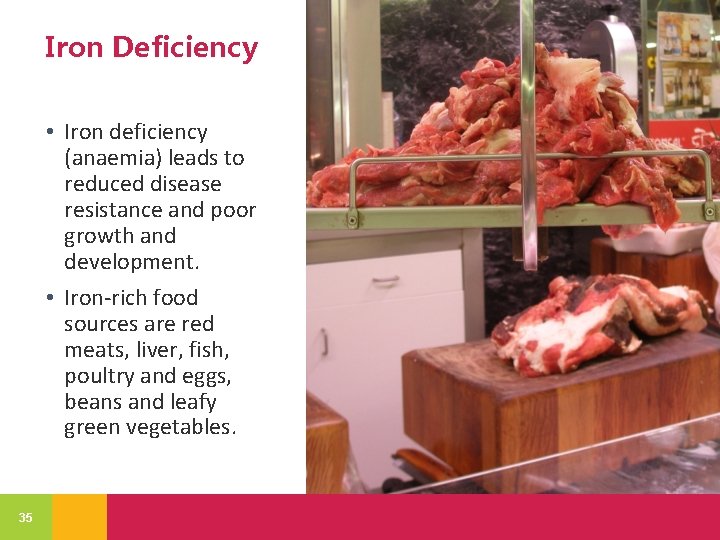 Iron Deficiency • Iron deficiency (anaemia) leads to reduced disease resistance and poor growth