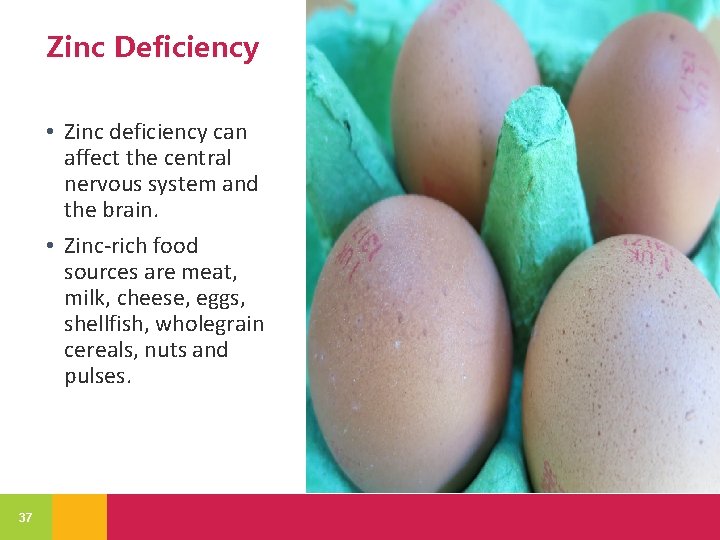Zinc Deficiency • Zinc deficiency can affect the central nervous system and the brain.