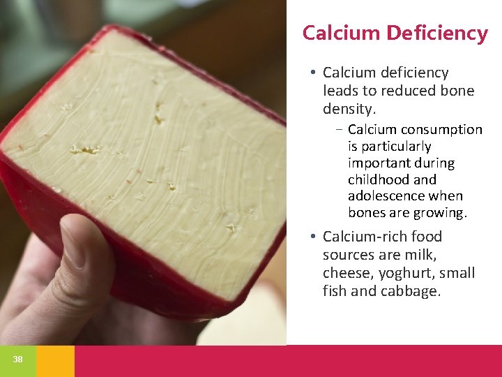 Calcium Deficiency • Calcium deficiency leads to reduced bone density. − Calcium consumption is