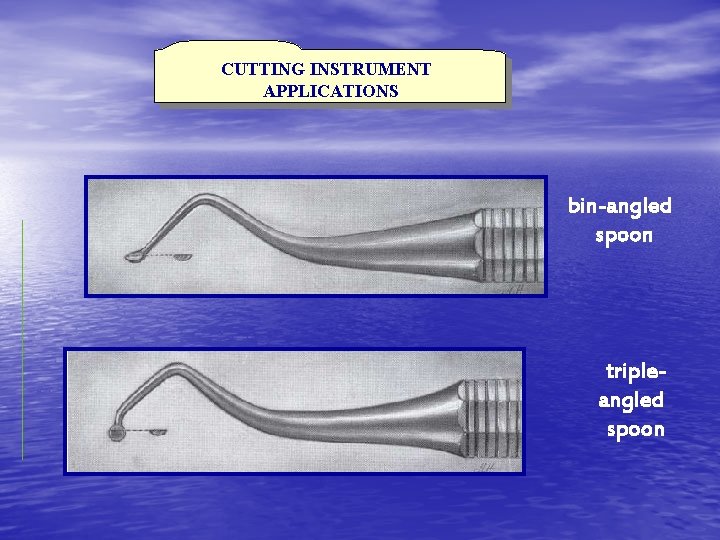 CUTTING INSTRUMENT APPLICATIONS bin-angled spoon tripleangled spoon 