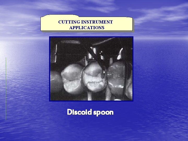 CUTTING INSTRUMENT APPLICATIONS Discoid spoon 