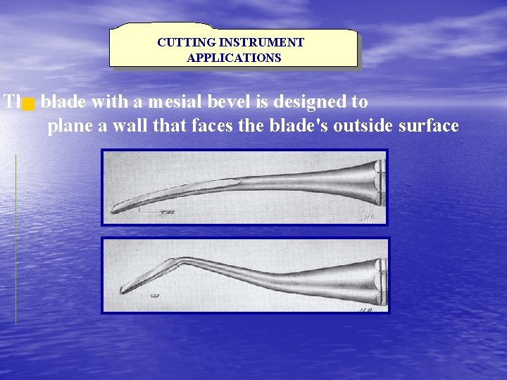 CUTTING INSTRUMENT APPLICATIONS The blade with a mesial bevel is designed to plane a