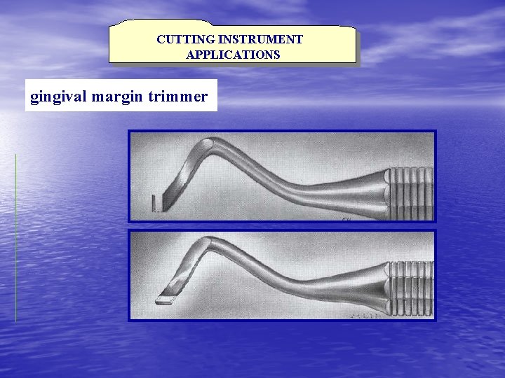 CUTTING INSTRUMENT APPLICATIONS gingival margin trimmer 