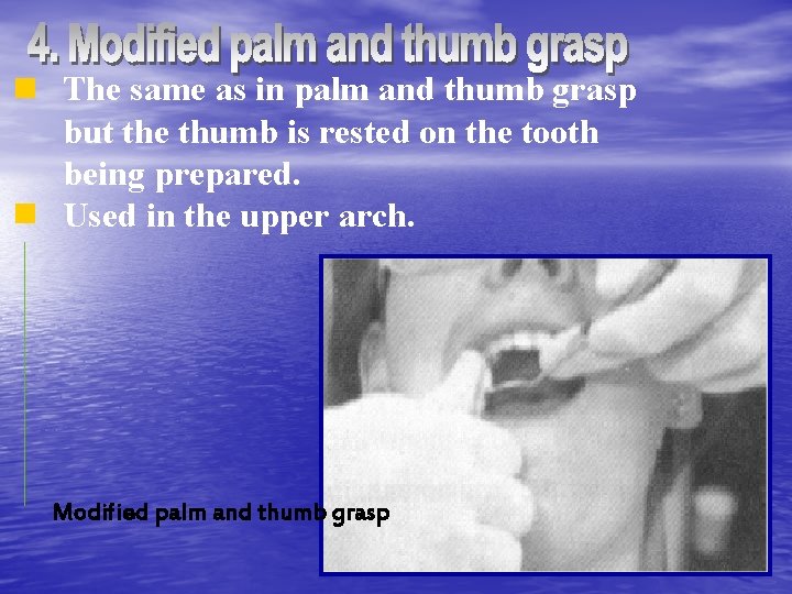 The same as in palm and thumb grasp but the thumb is rested on