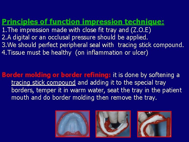 Principles of function impression technique: 1. The impression made with close fit tray and