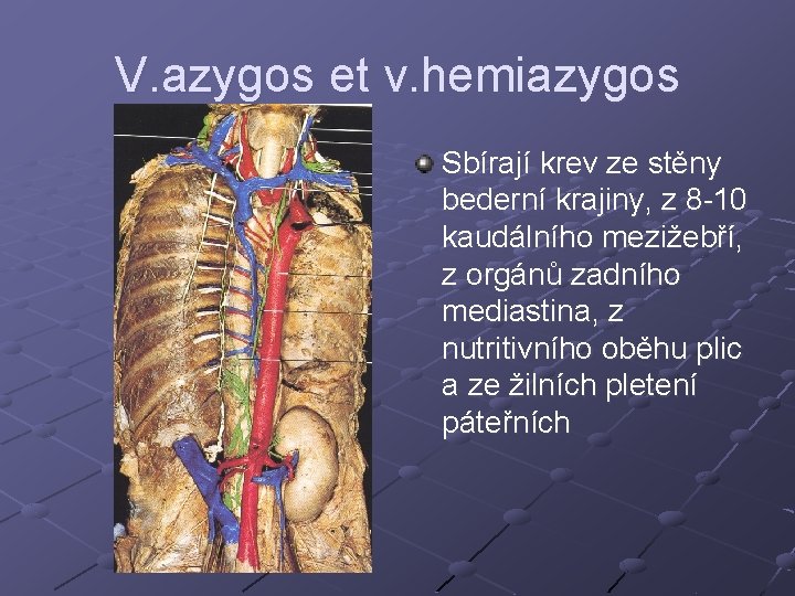 V. azygos et v. hemiazygos Sbírají krev ze stěny bederní krajiny, z 8 -10 V. azygos et v. hemiazygos Sbírají krev ze stěny bederní krajiny, z 8 -10