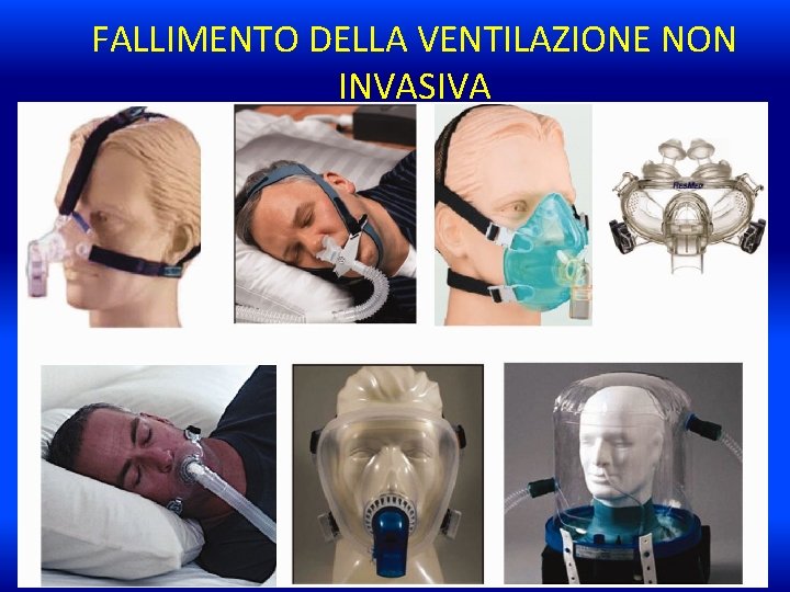 FALLIMENTO DELLA VENTILAZIONE NON INVASIVA 1) PREVENIRE • La NIV deve essere applicata in