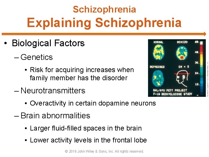 Schizophrenia Explaining Schizophrenia • Biological Factors – Genetics • Risk for acquiring increases when