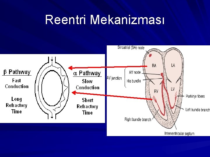 Reentri Mekanizması Reentri Mekanizması