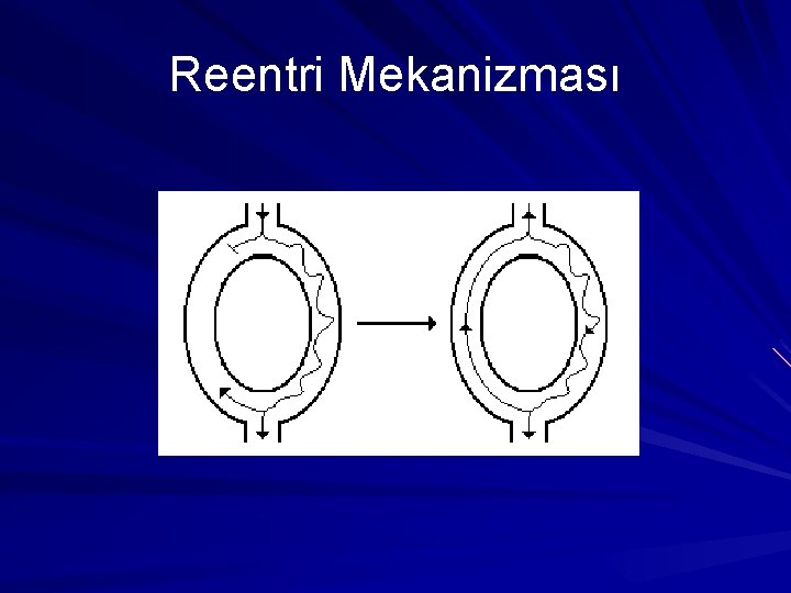 Reentri Mekanizması Reentri Mekanizması